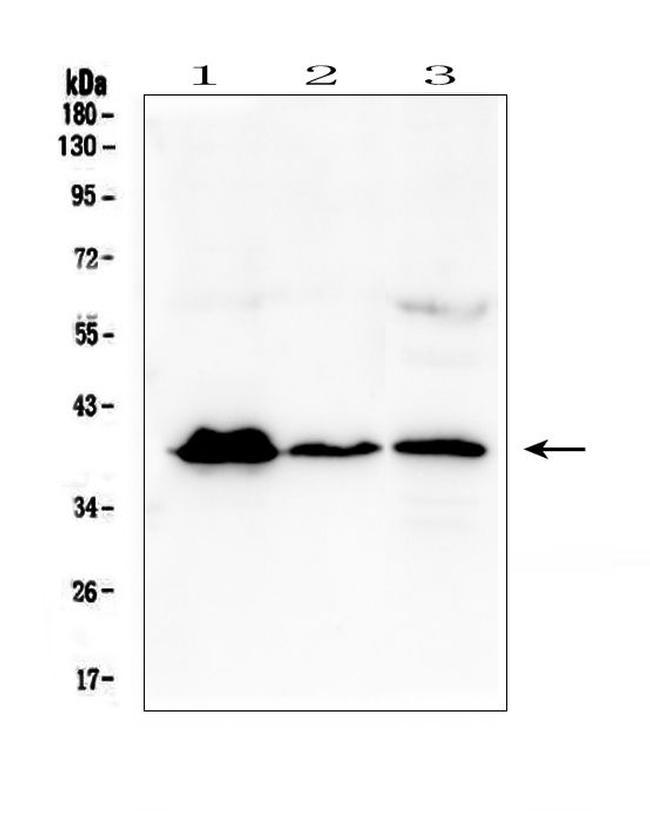 MR1 Antibody in Western Blot (WB)