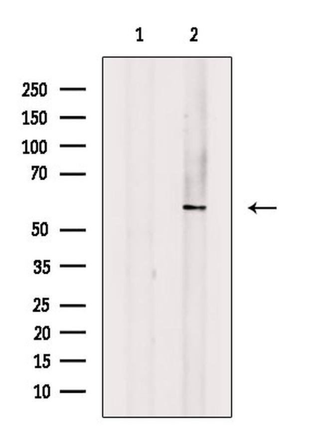 Phospho-p57 Kip2 (Thr310) Antibody in Western Blot (WB)