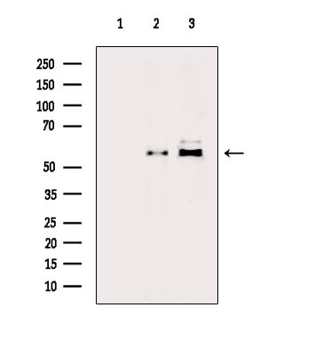 Phospho-PFKFB3 (Ser461) Antibody in Western Blot (WB)