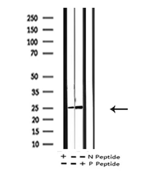 Phospho-Phospholamban (Ser16, Thr17) Antibody in Western Blot (WB)