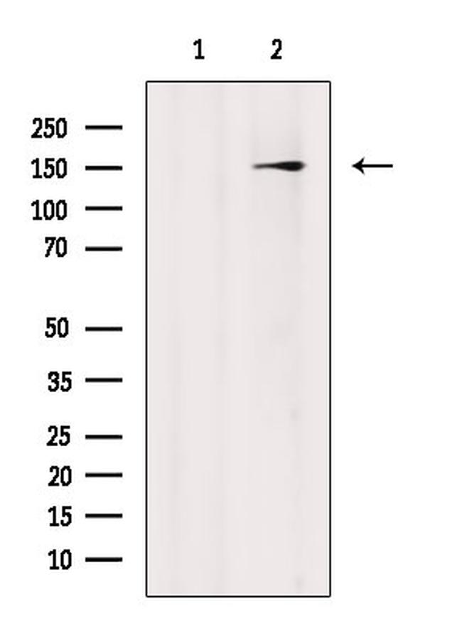 Phospho-ROCK1 (Thr455, Ser456) Antibody in Western Blot (WB)