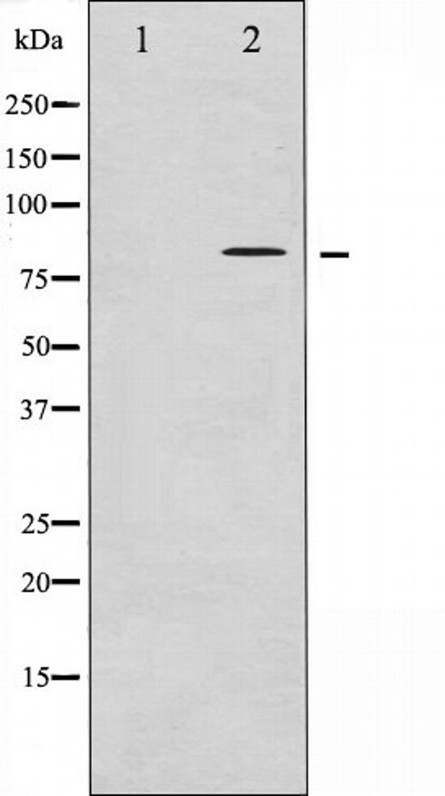 Phospho-Tau (Thr498) Antibody in Western Blot (WB)
