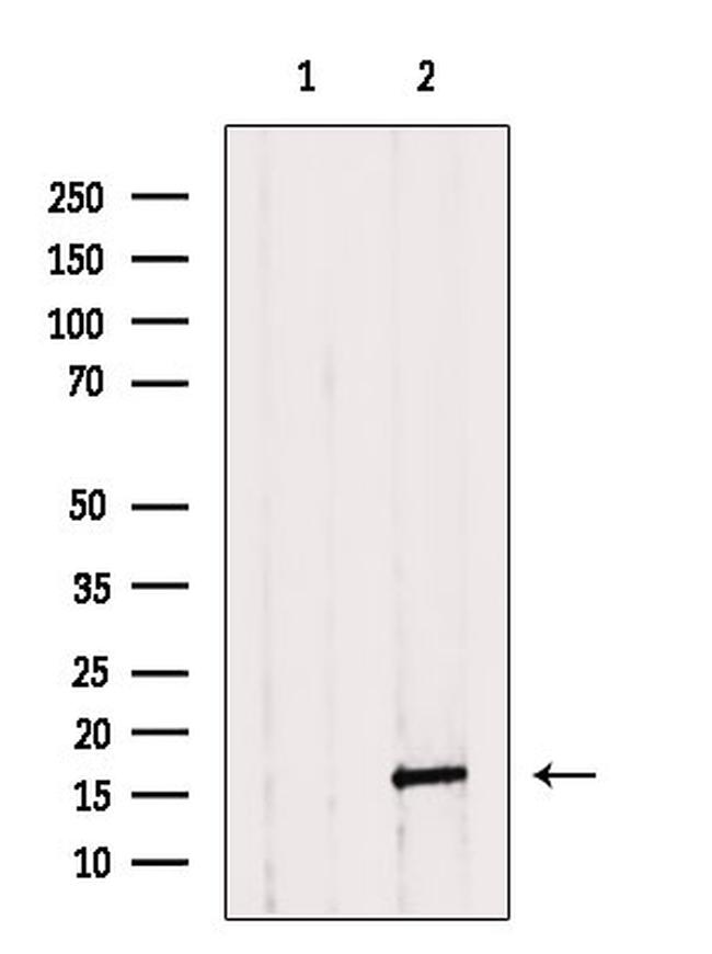 Caspase 3 (Cleaved Asp175) Antibody in Western Blot (WB)