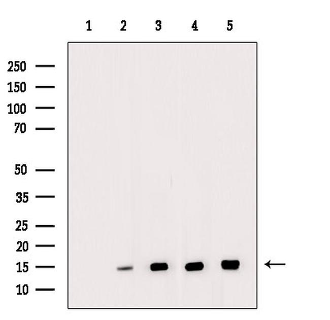 H2BK20ac Antibody in Western Blot (WB)