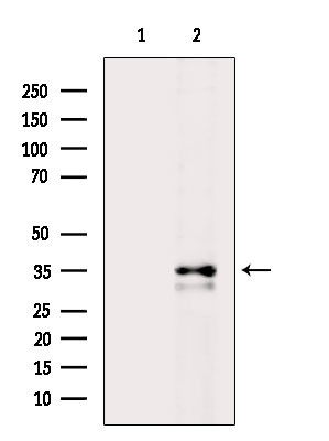 CCR1 Antibody in Western Blot (WB)