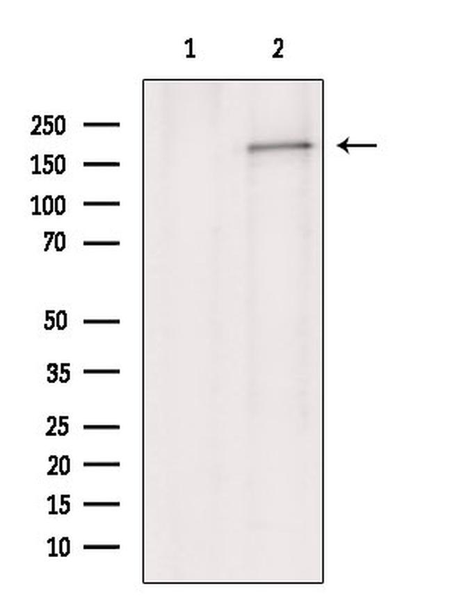 MRP1 Antibody in Western Blot (WB)