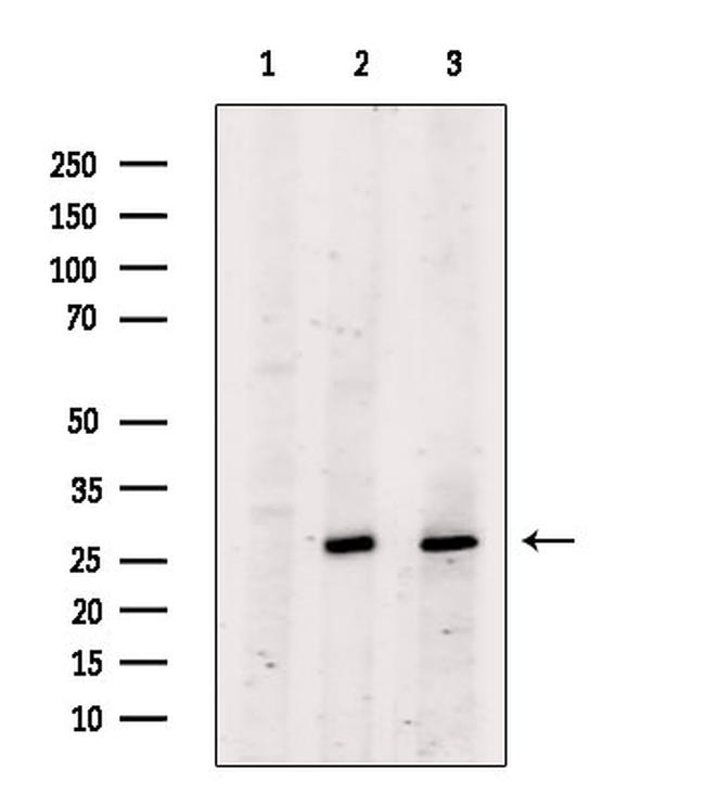 BCL-2 Antibody in Western Blot (WB)