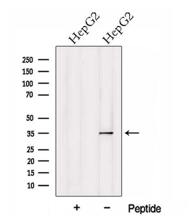 HtrA1 Antibody in Western Blot (WB)