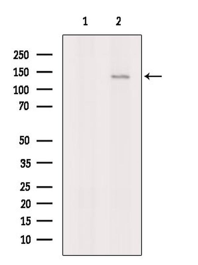 CD61 Antibody in Western Blot (WB)