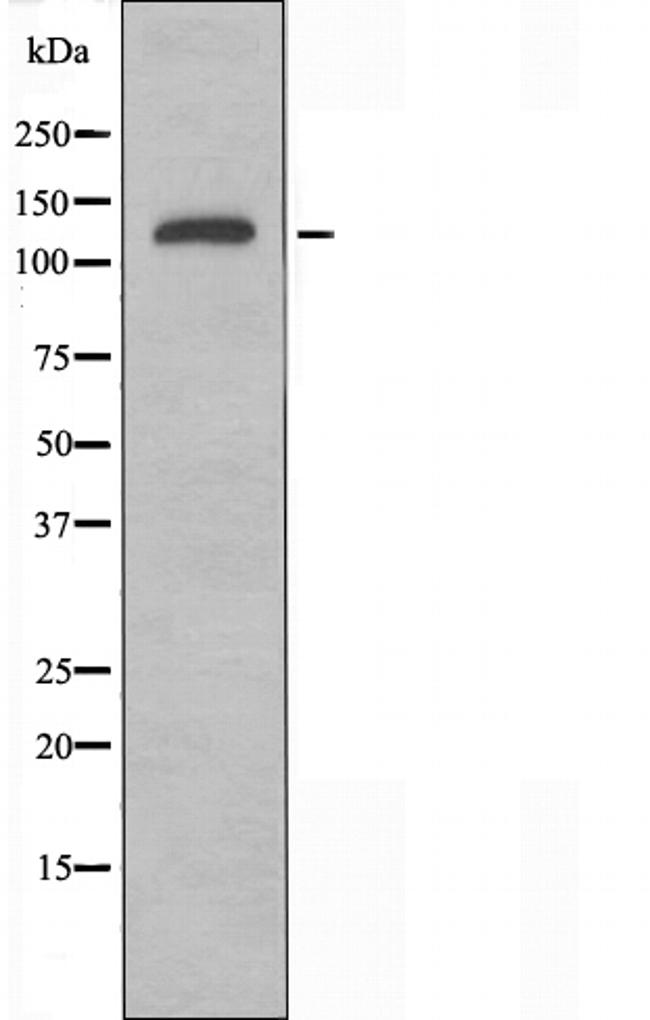 KIF4A Antibody in Western Blot (WB)