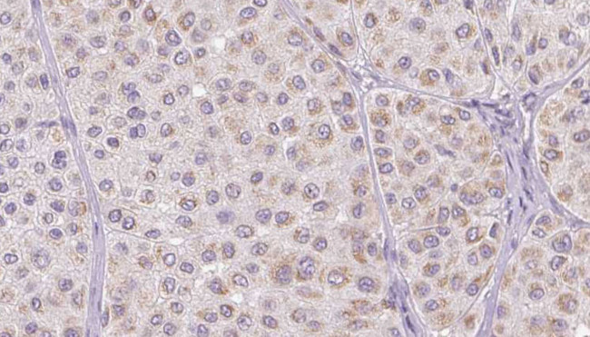 MCP-1 Antibody in Immunohistochemistry (Paraffin) (IHC (P))
