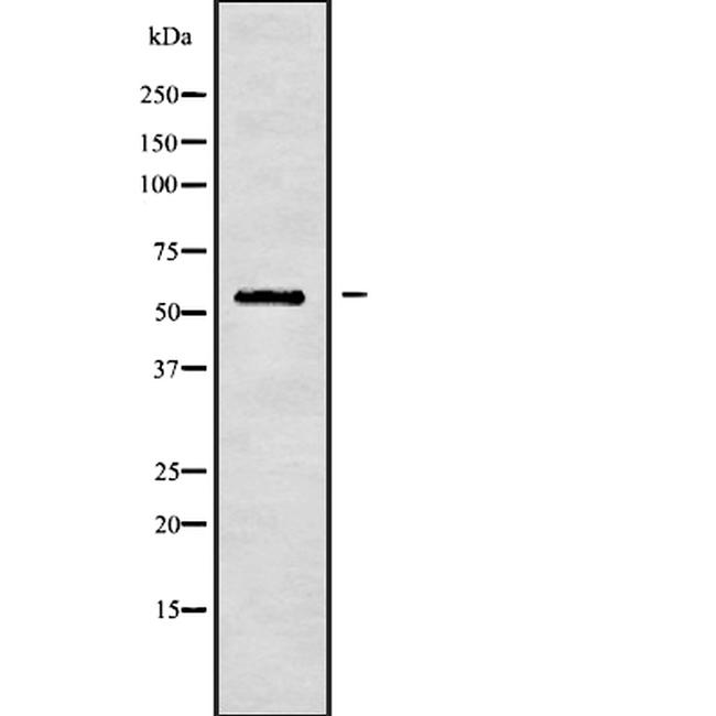 MYLK2 Antibody in Western Blot (WB)