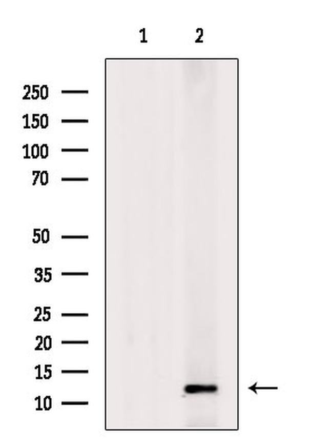S100A6 Antibody in Western Blot (WB)