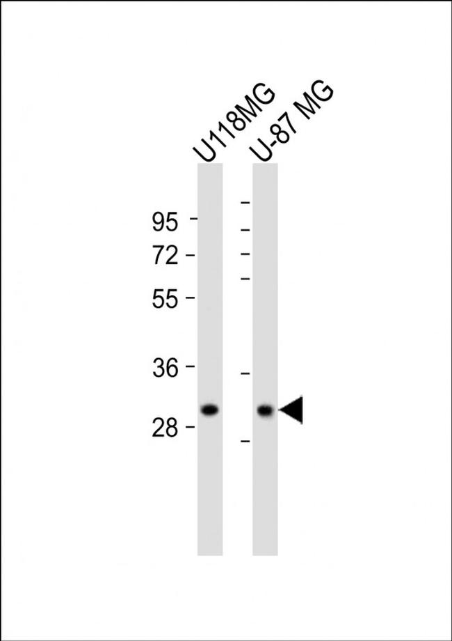 STX1B Antibody in Western Blot (WB)