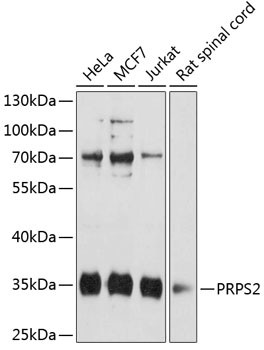 PRPS2 Antibody in Western Blot (WB)