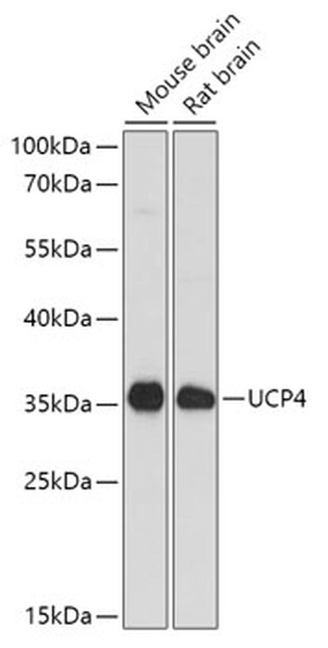 UCP4 Antibody in Western Blot (WB)