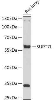 SUPT7L Antibody in Western Blot (WB)