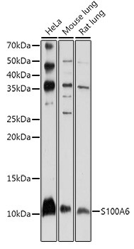 S100A6 Antibody in Western Blot (WB)