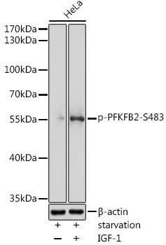 Phospho-PFKFB2 (Ser483) Antibody in Western Blot (WB)