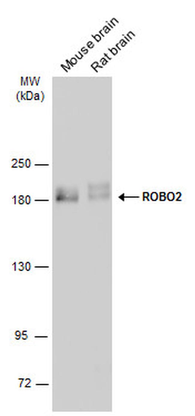 Robo2 Antibody in Western Blot (WB)