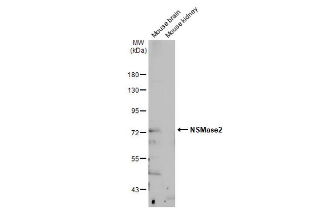 SMPD3 Antibody in Western Blot (WB)