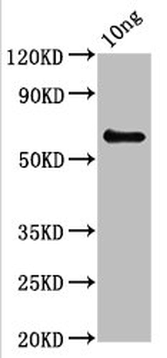 Mycoplasma pneumoniae XPNPEP1 Antibody in Western Blot (WB)