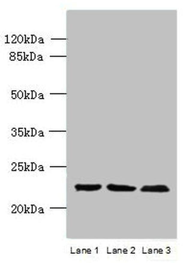 WDYHV1 Antibody in Western Blot (WB)