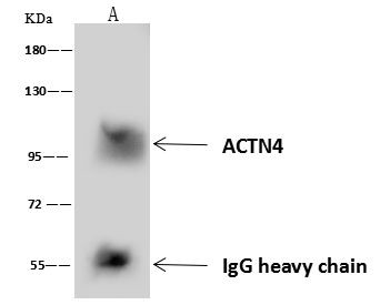 alpha Actinin 4 Antibody in Immunoprecipitation (IP)