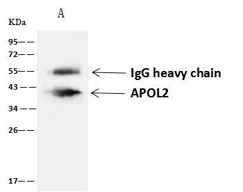 Apolipoprotein L2 Antibody in Immunoprecipitation (IP)