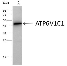 V-ATPase C1 Antibody in Immunoprecipitation (IP)