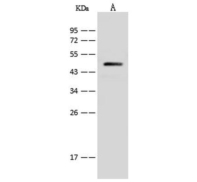 V-ATPase C1 Antibody in Western Blot (WB)