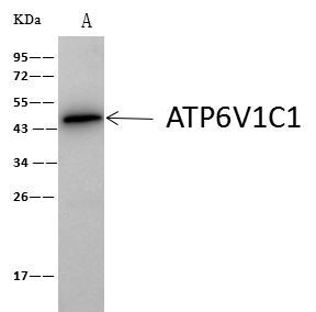 V-ATPase C1 Antibody in Immunoprecipitation (IP)