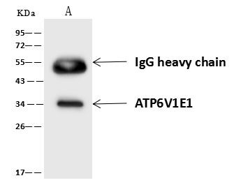 ATP6V1E1 Antibody in Immunoprecipitation (IP)
