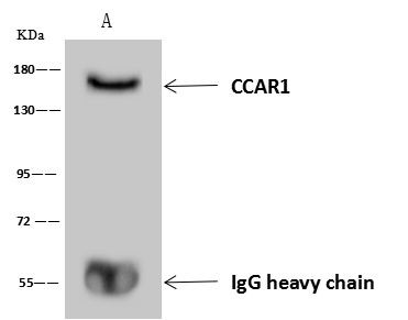 CCAR1 Antibody in Immunoprecipitation (IP)