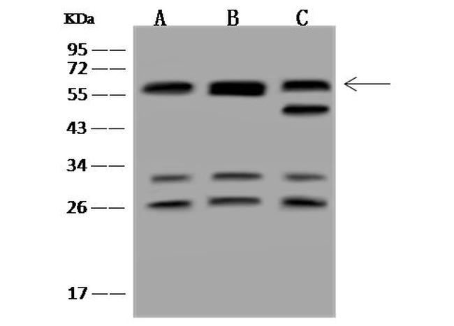 CD2BP2 Antibody in Western Blot (WB)