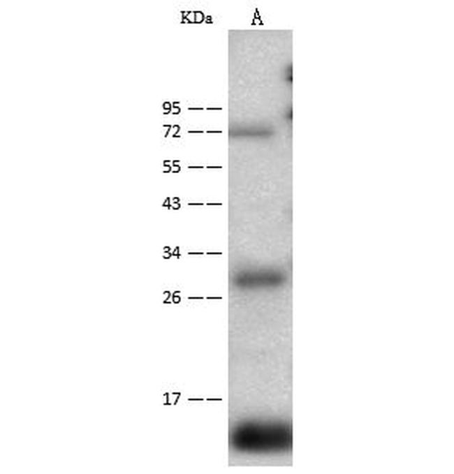 CD59 Antibody in Western Blot (WB)