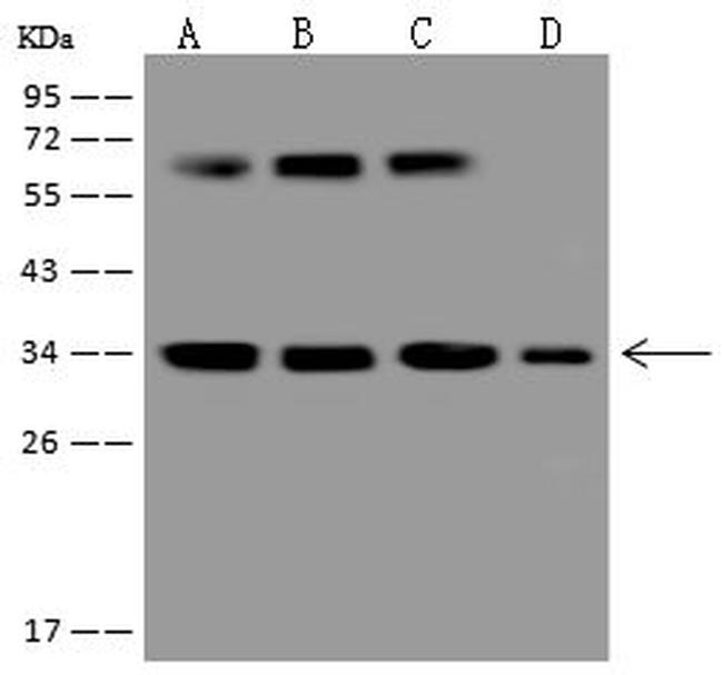 CYB5R1 Antibody in Western Blot (WB)