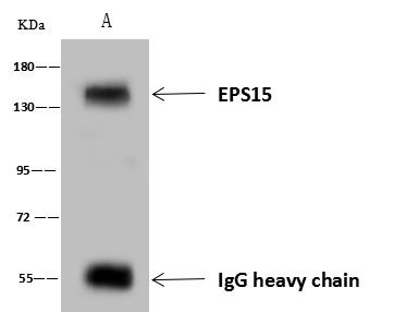 EPS15 Antibody in Immunoprecipitation (IP)
