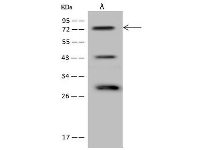 FIGNL1 Antibody in Western Blot (WB)