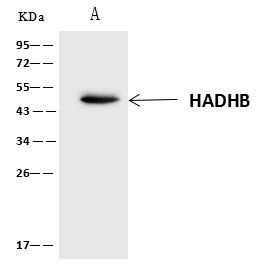 HADHB Antibody in Immunoprecipitation (IP)