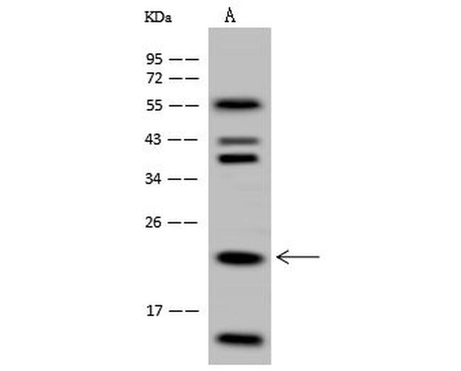 HINT3 Antibody in Western Blot (WB)