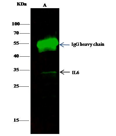 IL-6 Antibody in Immunoprecipitation (IP)