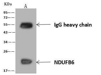 NDUFB6 Antibody in Immunoprecipitation (IP)