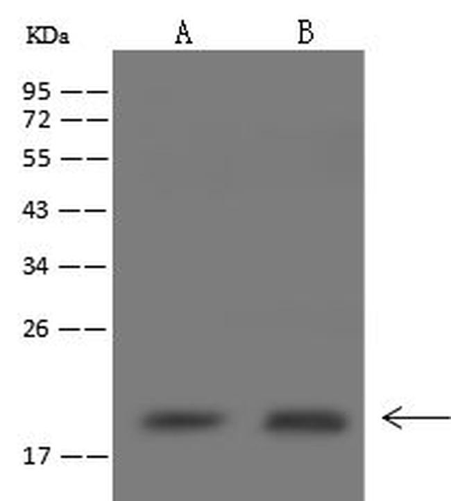 NDUFB6 Antibody in Western Blot (WB)