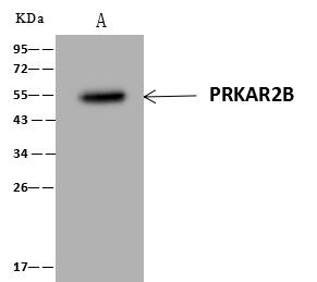 PRKAR2B Antibody in Immunoprecipitation (IP)