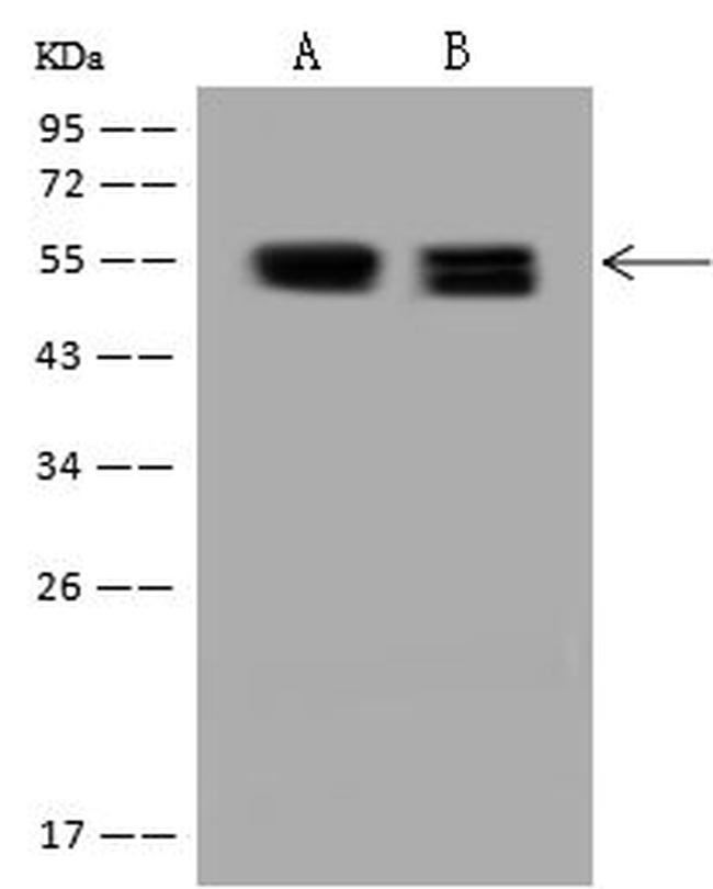 PRKAR2B Antibody in Western Blot (WB)