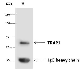 TRAP1 Antibody in Immunoprecipitation (IP)