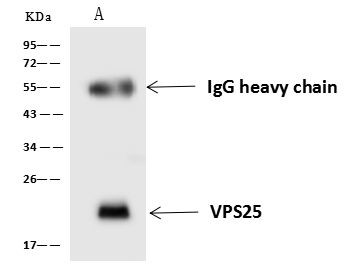 VPS25 Antibody in Immunoprecipitation (IP)