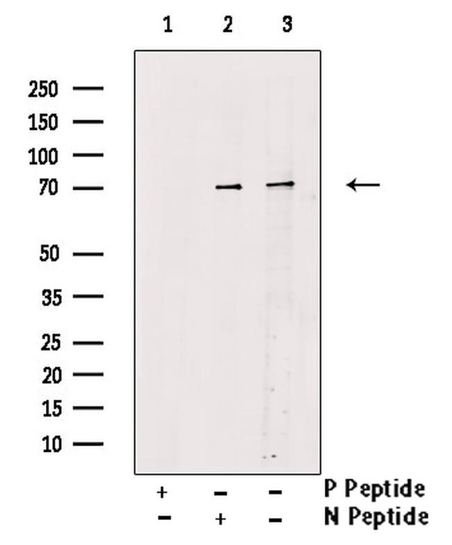Phospho-RIP2 (Ser176) Antibody in Western Blot (WB)