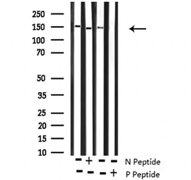 Phospho-ROCK2 (Tyr722) Antibody in Western Blot (WB)